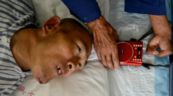 Walaupun sudah berusia 80 tahun, selama 50 tahun terakhir ini seorang ayah masih terus tabah merawat anaknya yang menderita polio. (Sumber Tencent)