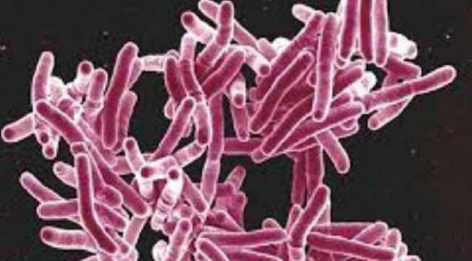 Mycobacterium tuberculosis, bakteri penyebab TB (Sumber NIAID)