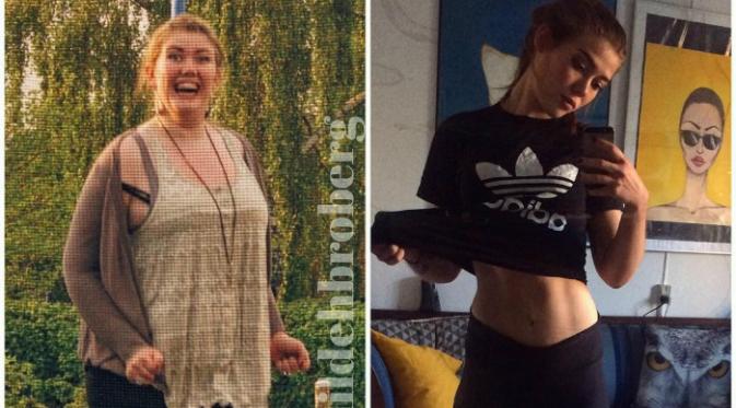 Sebelum berat badannya turun hingga 54 kilogram, Mathilde memiliki bobot tubuh 121 kilogram.(Uniland.co.uk)