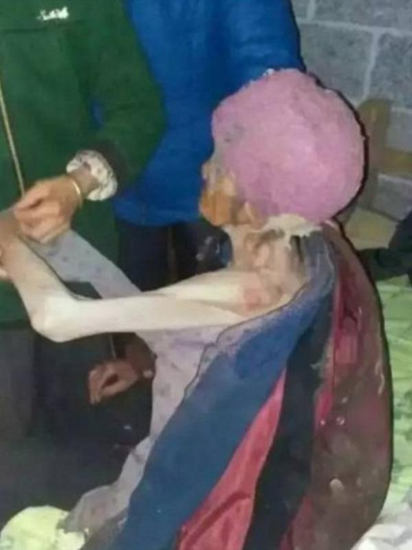 Nenek berusia 92 tahun menjalani pemulihan setelah dikeluarkan dari kerangkeng oleh pihak berwajib. (Dailymail)