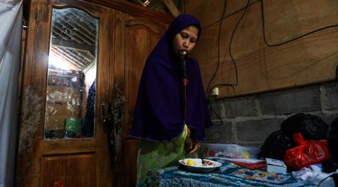 Sulami, gadis penderita kelumpuhan warga Dukuh Selorejo Wetan, Mojokerjo, Kedawung, Sragen, Jateng. (Liputan6.com/Fajar Abrori)‎