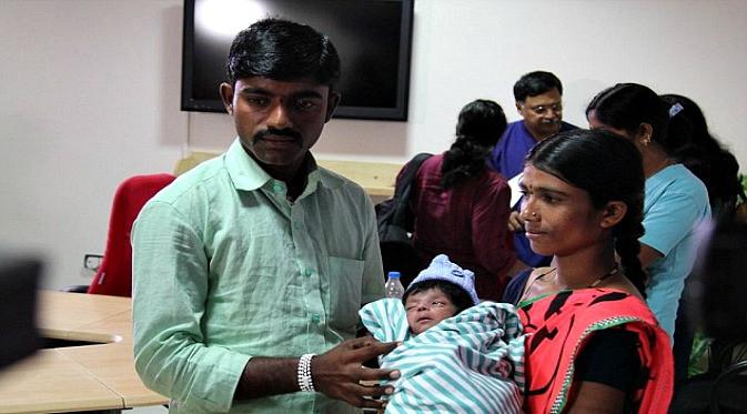 Awalnya, pasangan ini tidak mau bayi yang baru dilahirkan dioperasi. (Foto: Mail Online)