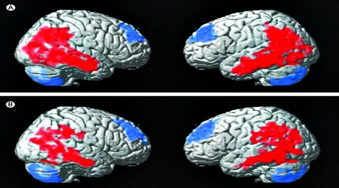 Stimulasi ke otak dengan kejutan listrik bantu pasien anoreksi. (Foto: The Lancet Psychiatry)