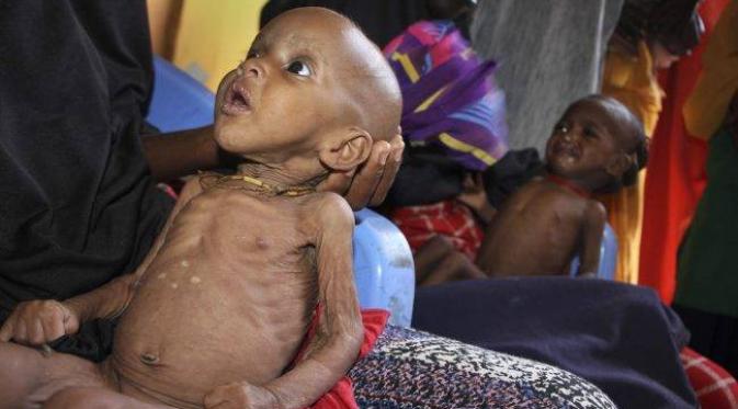  Dalam Dua Hari, 100 Orang Tewas Akibat Kelaparan di Somalia (AP)