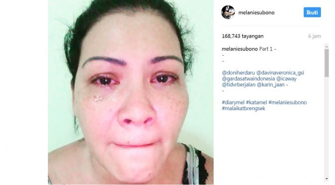 Melanie Subono menangis menceritakan anjingnya meninggal (Foto: Instagram)