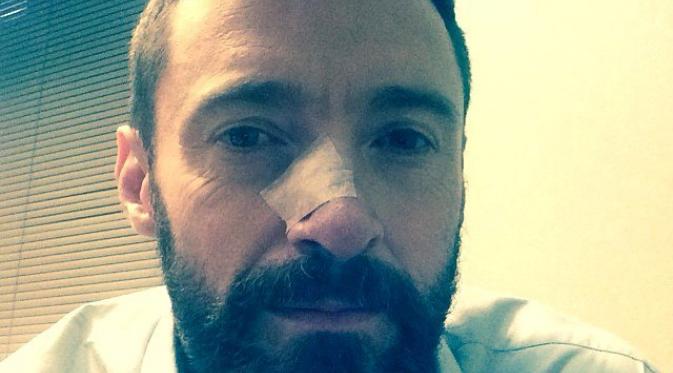 http://cdn1.production.liputan6.static6.com/medias/674797/big/hugh-jackman-reveals-another-skin-cancer-scare.jpg