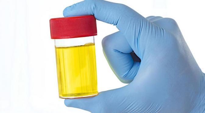 Sejumlah orang meyakini minum urine bisa bikin badan sehat. Namun, benarkah cara tersebut?