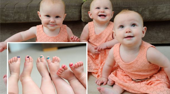 Pasangan suami istri Karen dan Ian Gilbert kesulitan membedakan 3 bayi perempuan mereka yang wajahnya mirip.