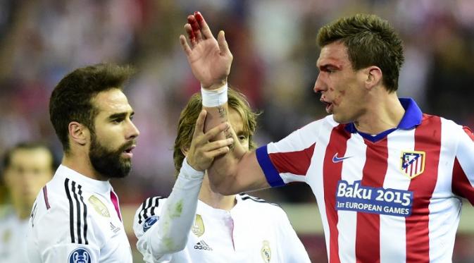 Pelipis striker Atletico Madrid Mario Mandzukic robek akibat terkena siku bek Real Madrid Sergio Ramos saat berebut bola di udara (GERARD JULIEN / AFP)