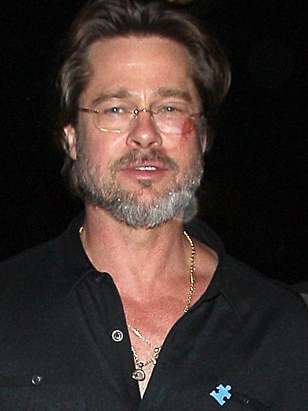 Memar akibat terjatuh di wajah Brad Pitt (via www.eonline.com)