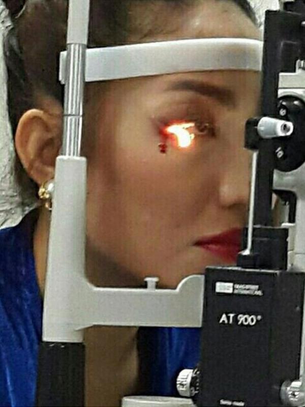 Pasca kejadian, luka masih terlihat jelas di mata Ayu Dewi. Darah pun bercucuran (via Instagram/Ayu Dewi)