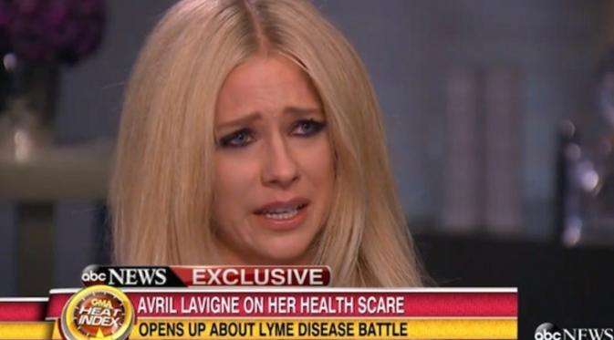 Dalam wawancara dengan Good Morning America, Avril Lavigne tak mampu menahan tangis saat menceritakan tentang penyakitnya.