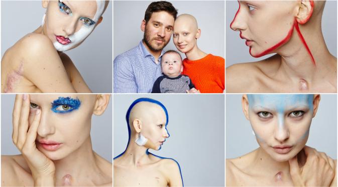 Model cantik yang menjadi botak setelah menjalani perawatan pascaoperasi kanker. (Huffington Post)