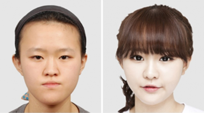 15 Foto Perubahan Wajah Orang Korea Setelah Operasi Pelastik | via: brilio.net