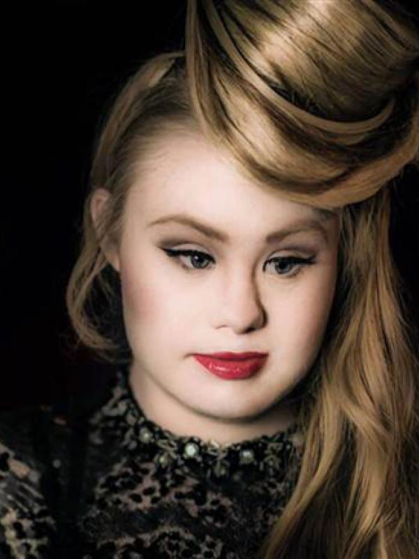 Madeline Stuart, Model Dengan Down Sindrom Tampil Di NYFW