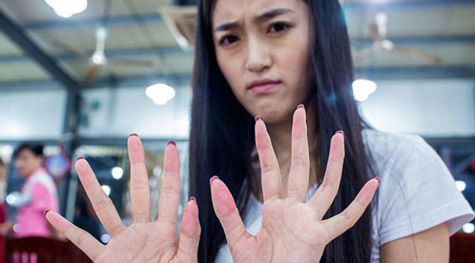 Xie menunjukkan tangannya memerah setelah mengupas kepiting/Dailymail.co.uk