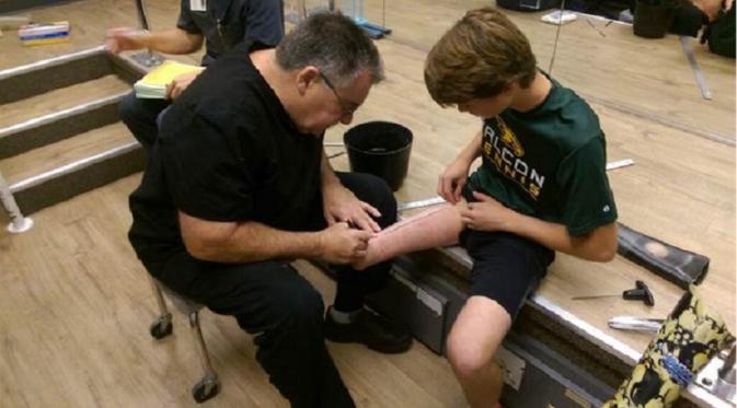 Ben Baltz harus kehilangan kaki akibat Osteocarcoma di usia 6 tahun. (Foto: Today.com)