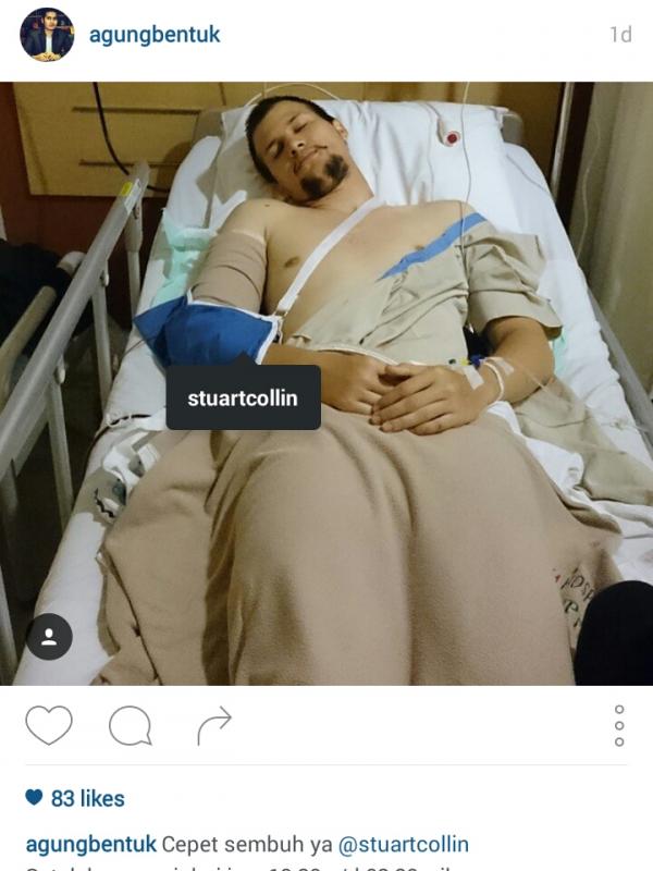 Manajar Stuart Collin, Agung, memperlihatkan kondisi terakhir sang artis usai dioperasi. (Instagram)