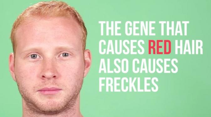 Gen yang menyebabkan rambut merah juga bisa menyebabkan bintik di kulit. (Via: youtube.com)