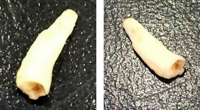 Gigi taring yang ditemukan disinyalir merupakan gigi tikus. (foto: Daily Mail)