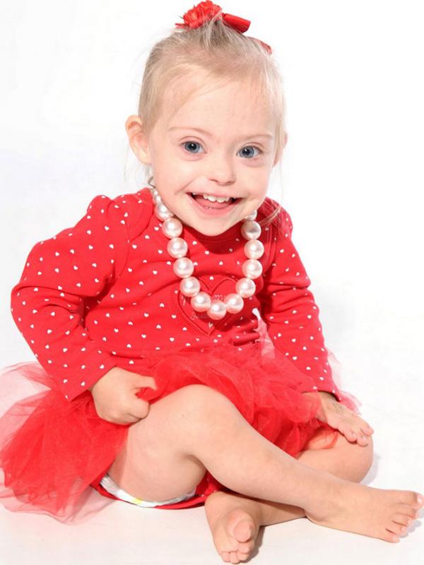 Connie-Rose, Bayi Down syndrome yang jadi model (foto: Boredpanda)