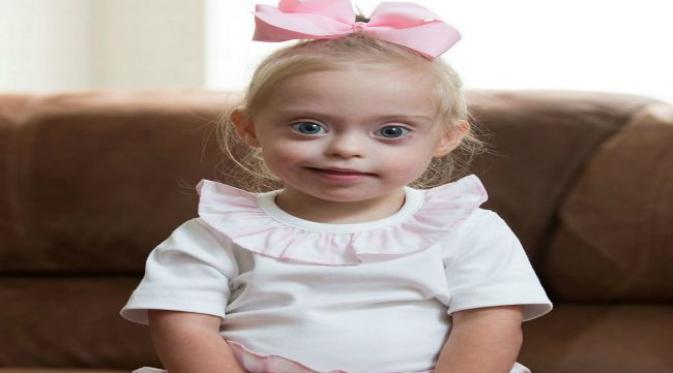 Connie-Rose Seaborn model penyandang Down Syndrome. (Bored Panda)